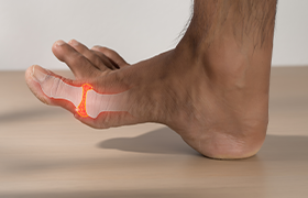 Abordaje de la crisis gotosa