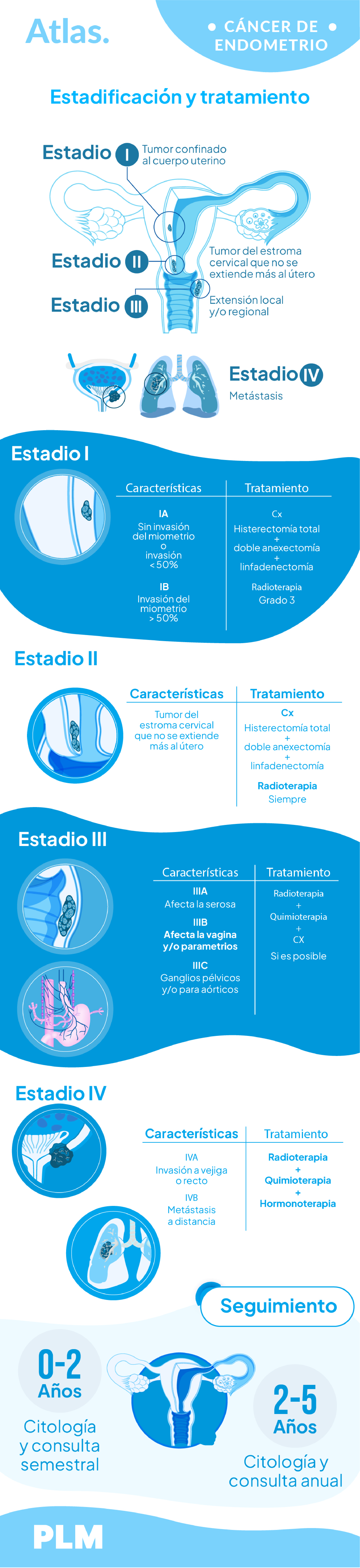 Cáncer de endometrio: Generalidades