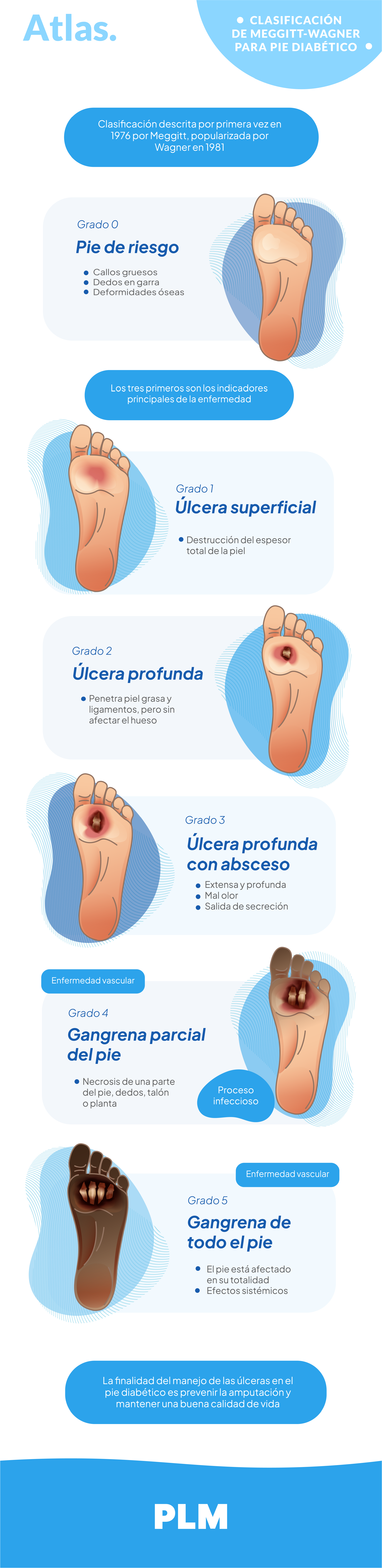 Clasificación de Meggitt-Wagner para pie diabético