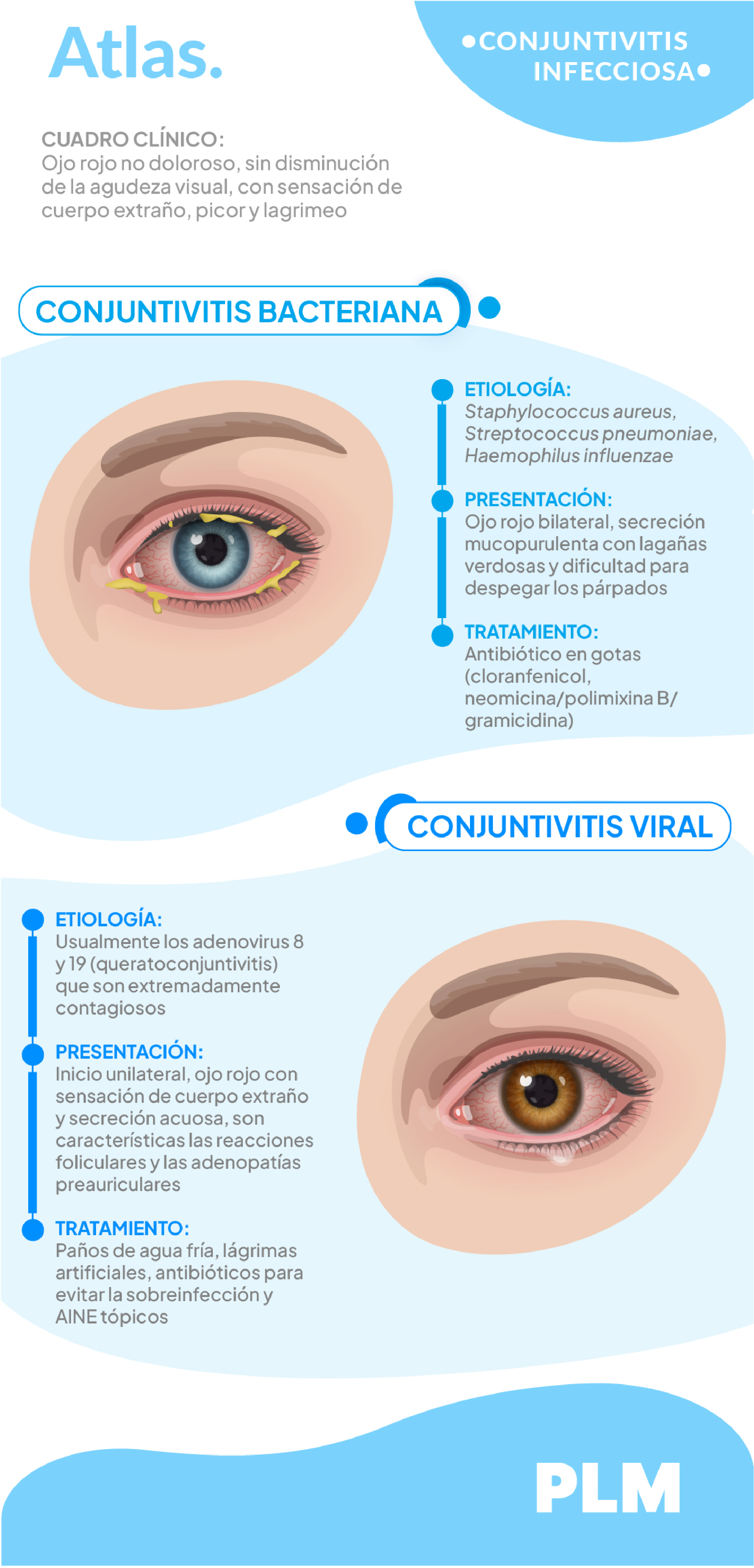 Conjuntivitis infecciosa