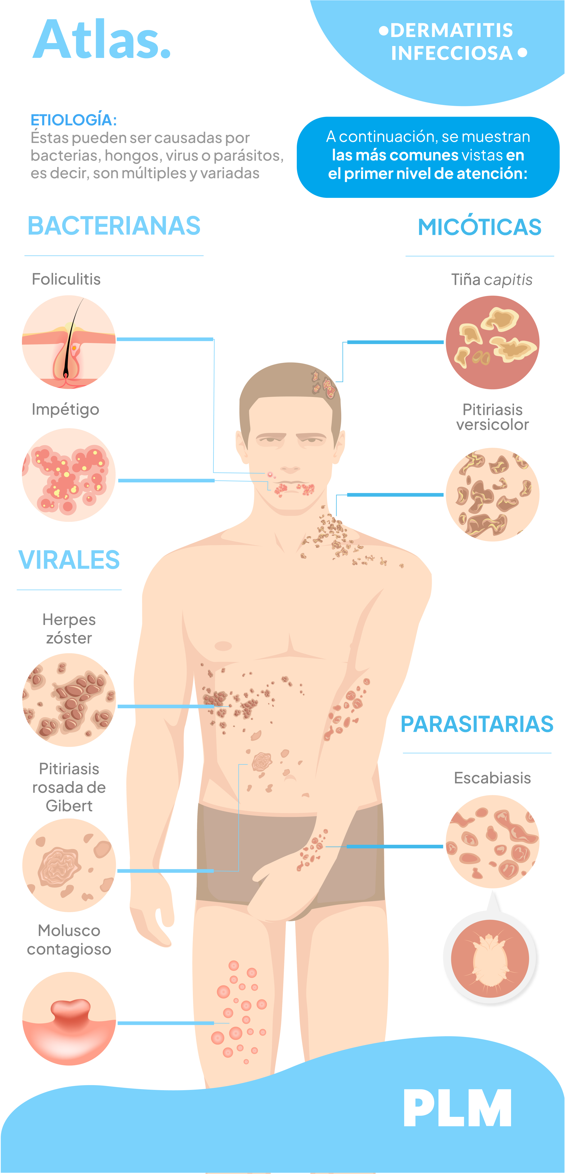 Dermatitis infecciosa