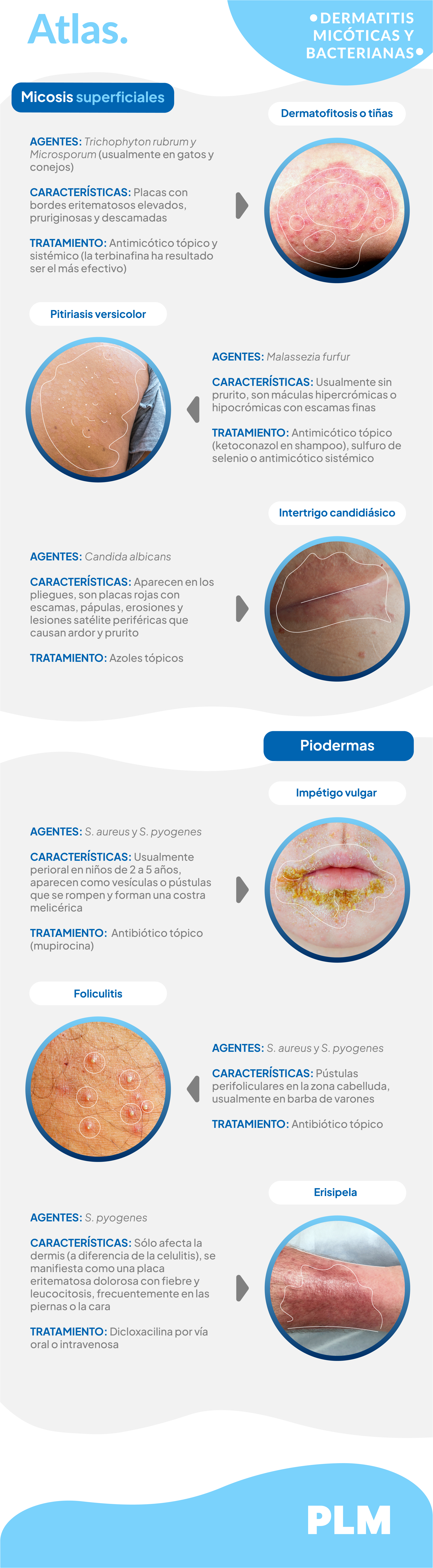 Dermatitis micóticas y bacterianas