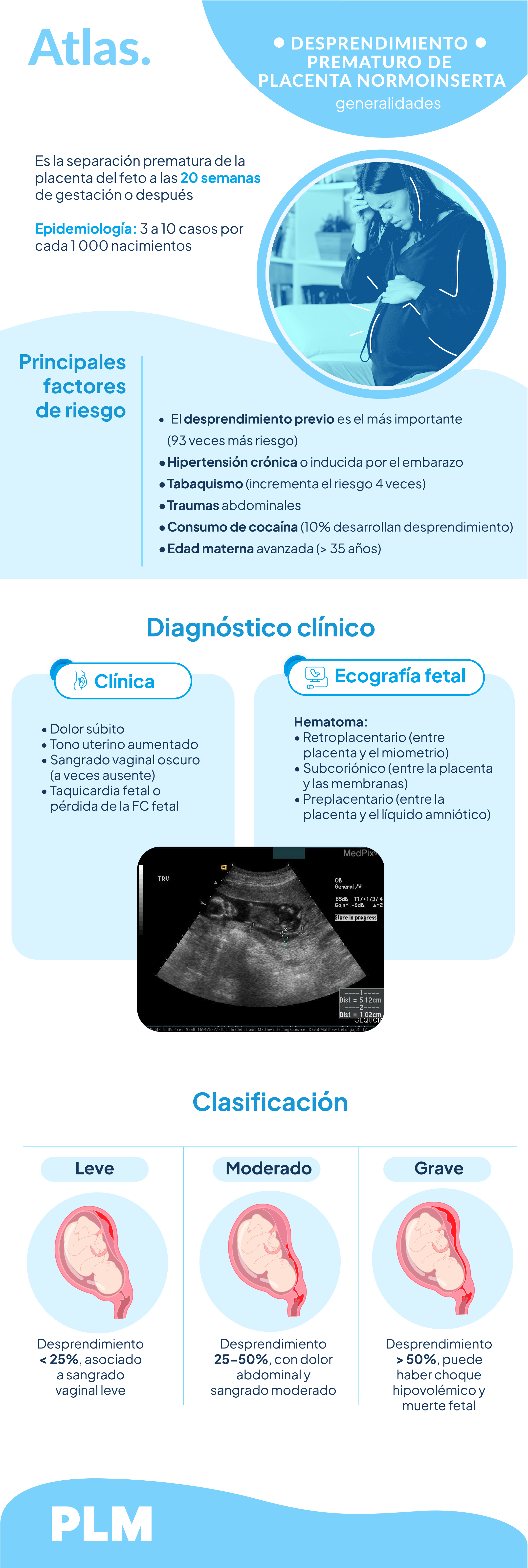 Desprendimiento prematuro de placenta normoinserta: generalidades
