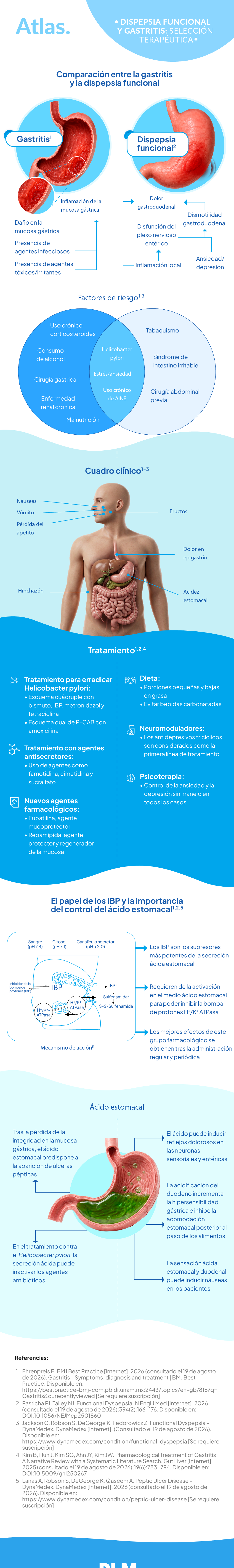 Dispepsia funcional y gastritis: selección terapéutica