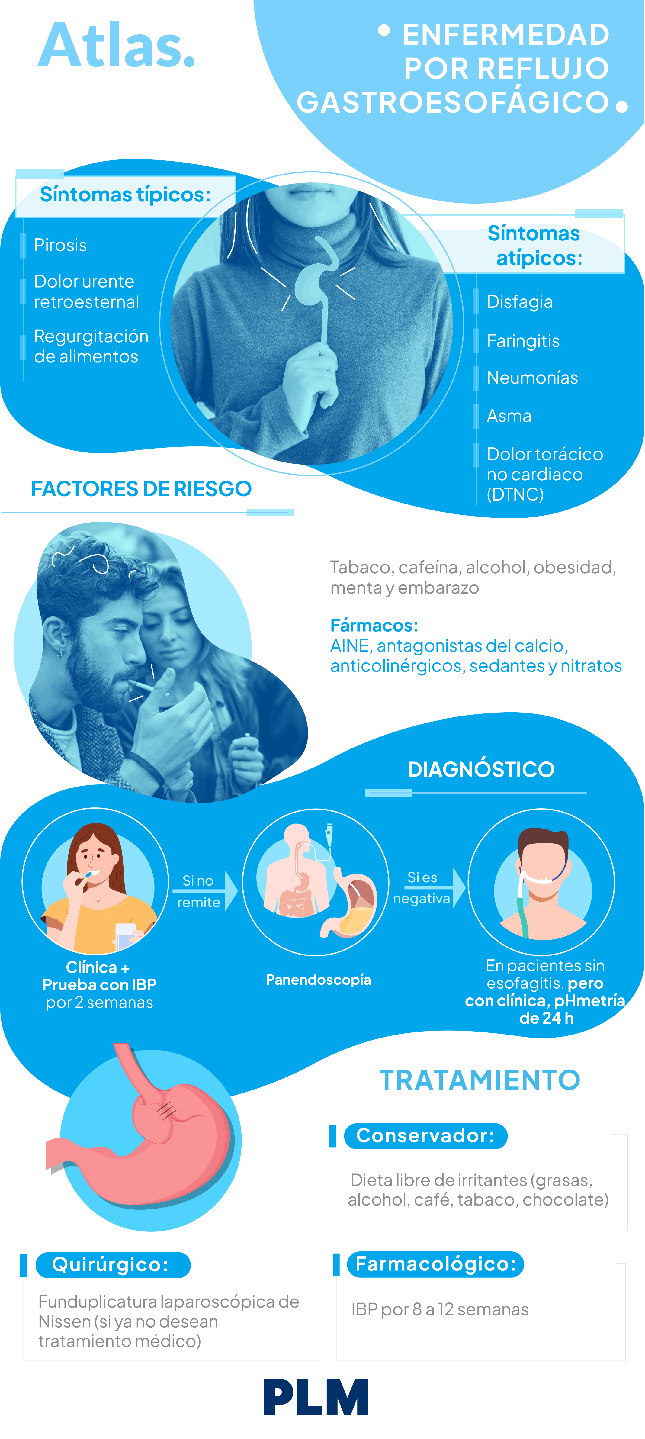 Enfermedad por reflujo gastroesofágico