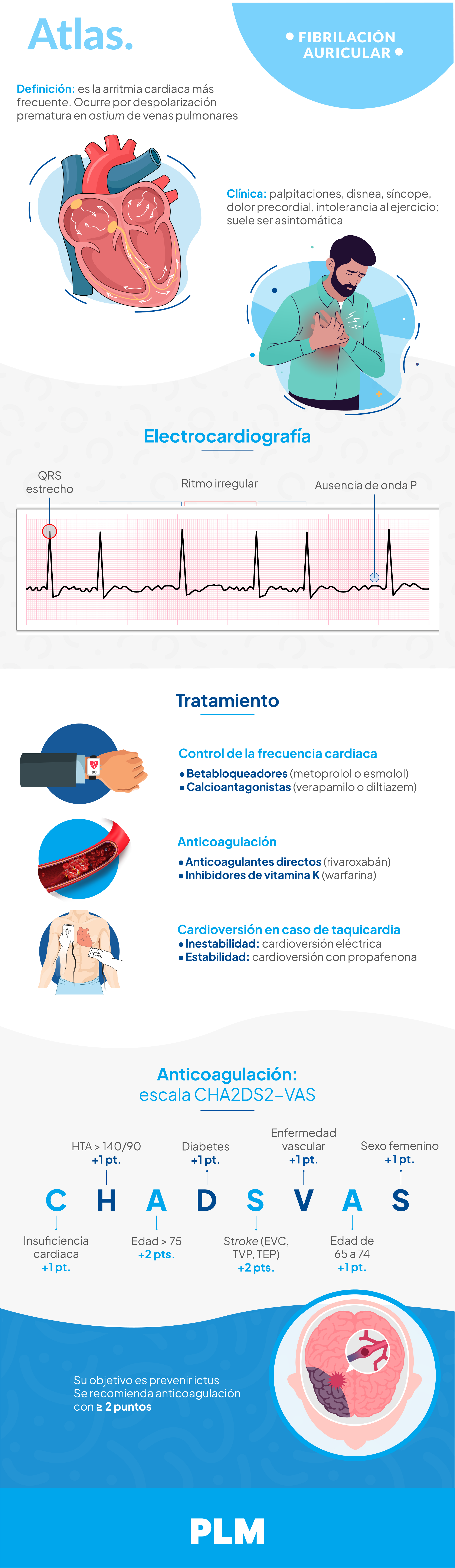 Fibrilación auricular