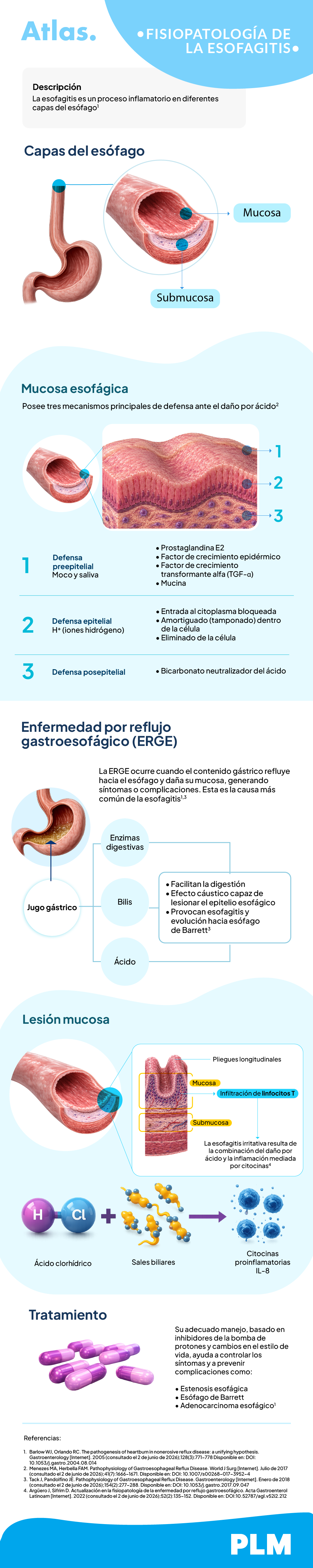 Fisiopatología de la esofagitis