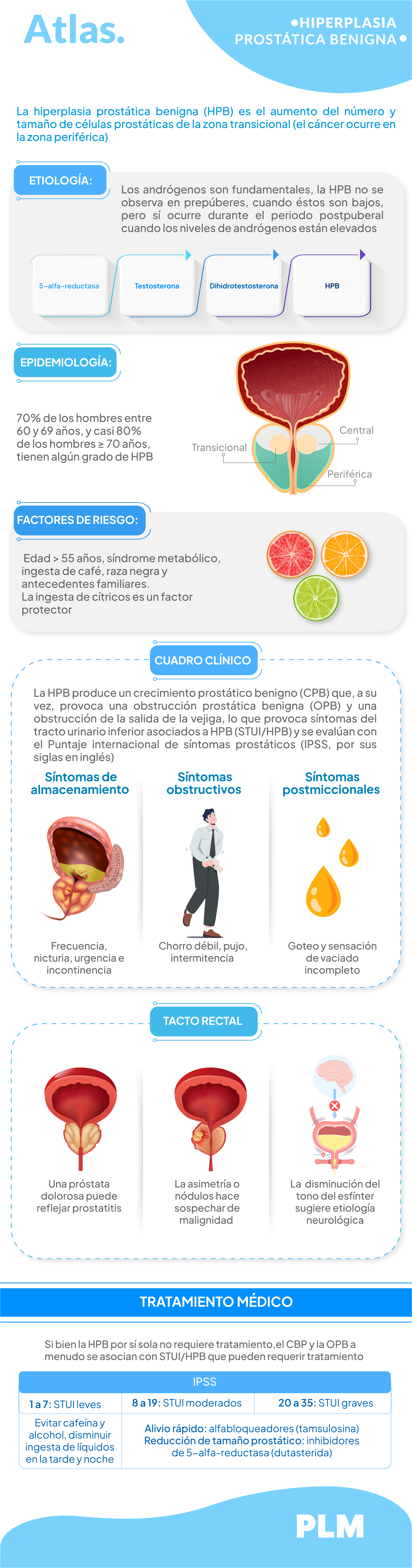 Hiperplasia prostática benigna