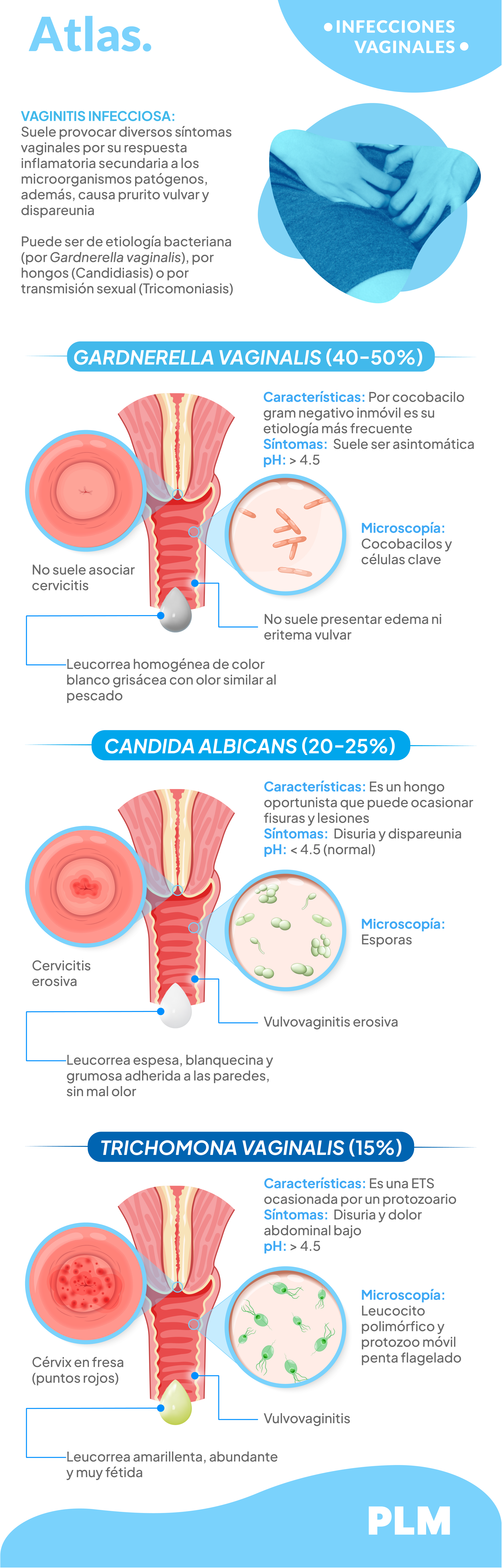 Infecciones vaginales
