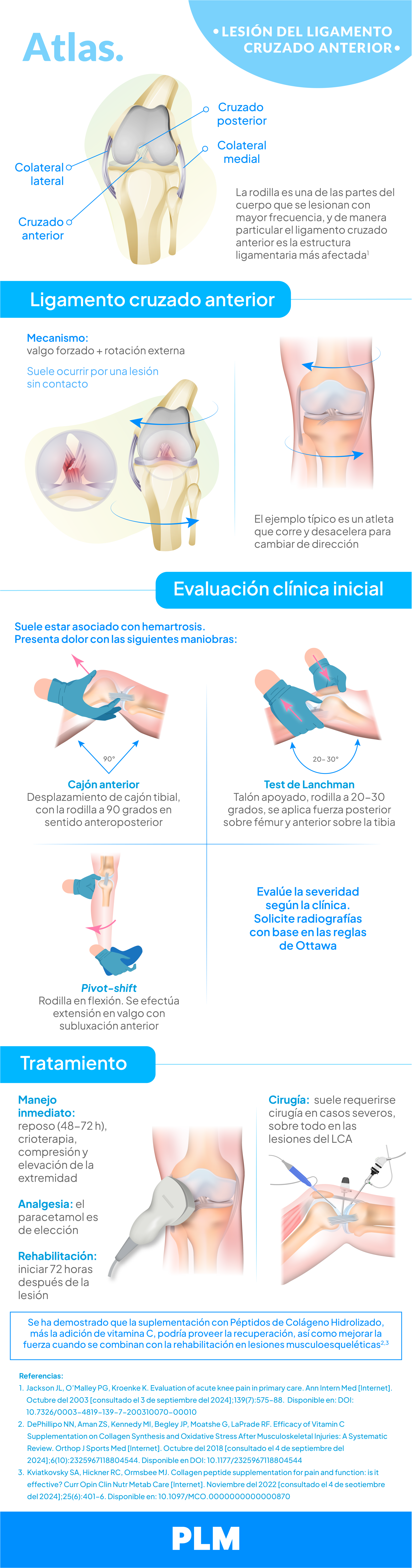 Lesión del ligamento cruzado anterior