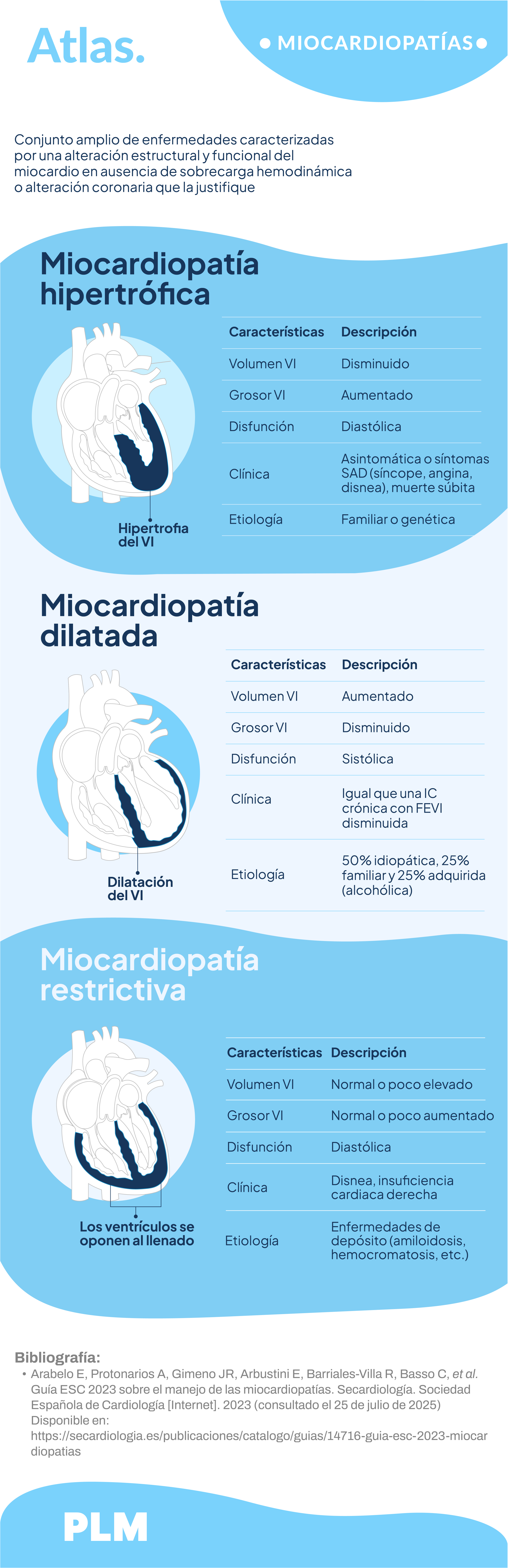 Miocardiopatías