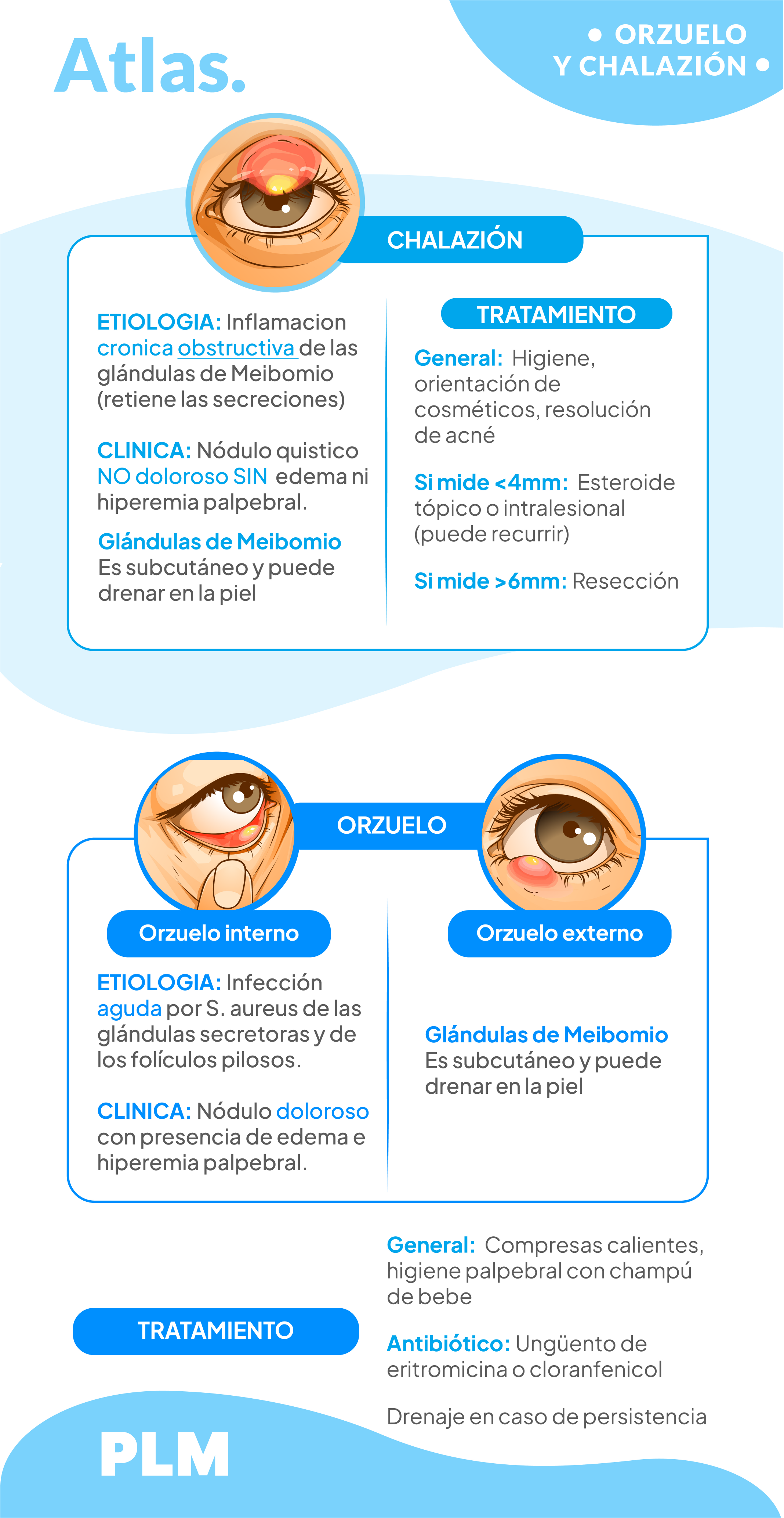 Orzuelo y chalazión