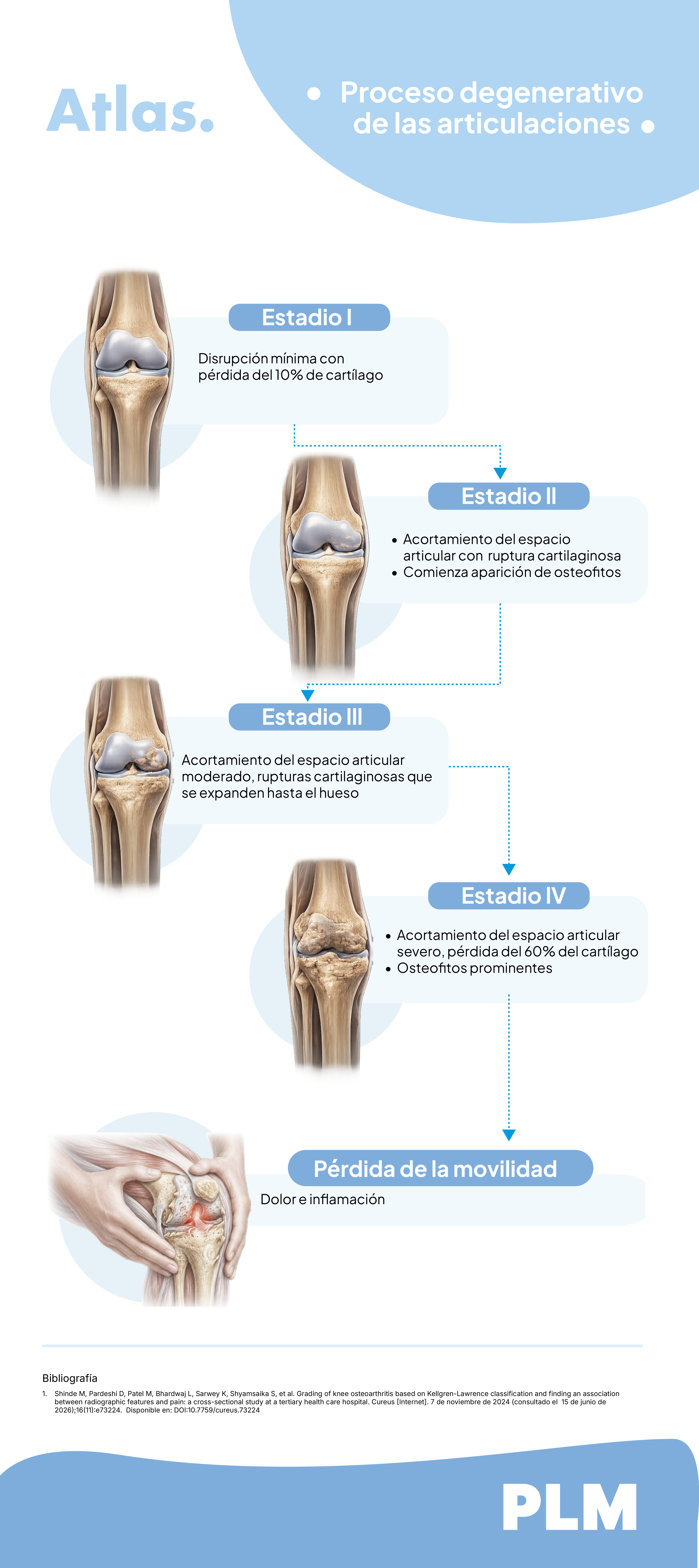 Proceso degenerativo de las articulaciones
