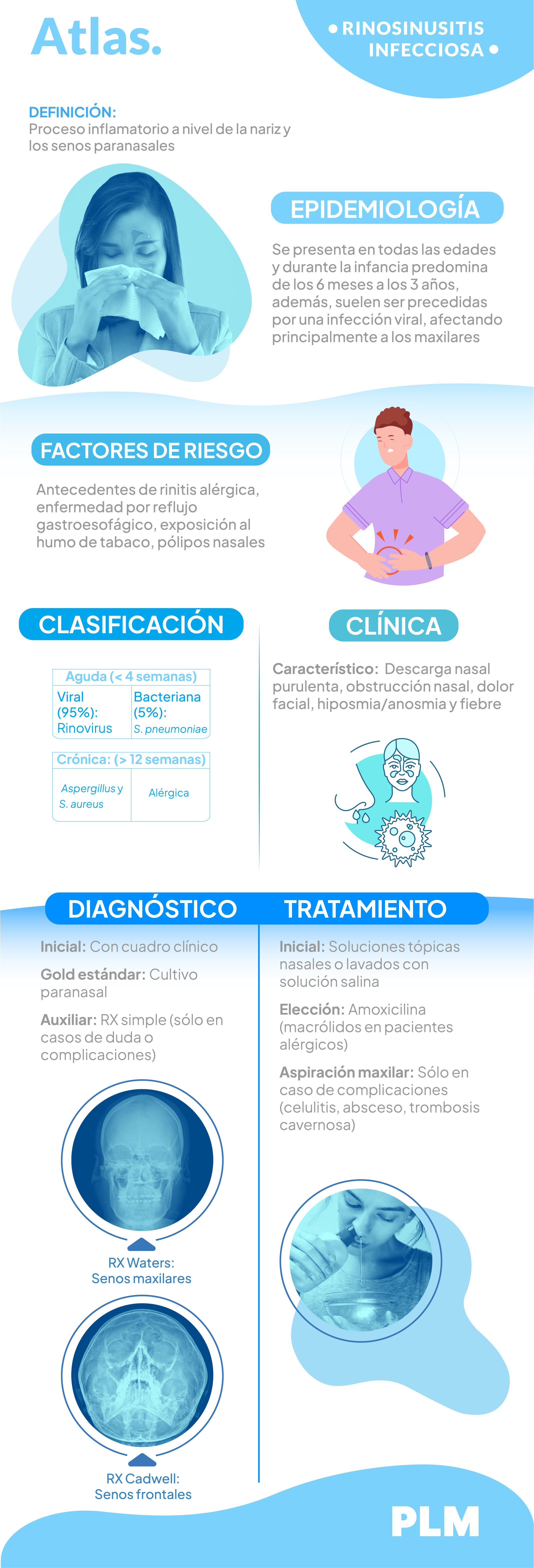 Rinosinusitis infecciosa