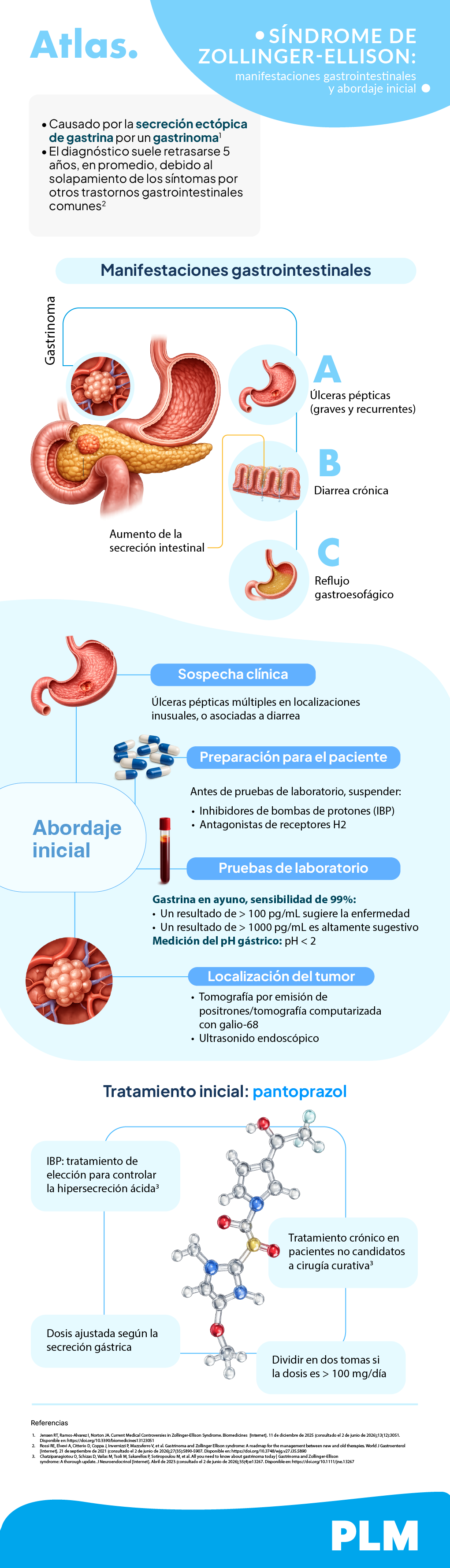 Síndrome de Zollinger-Ellison: manifestaciones gastrointestinales y abordaje inicial