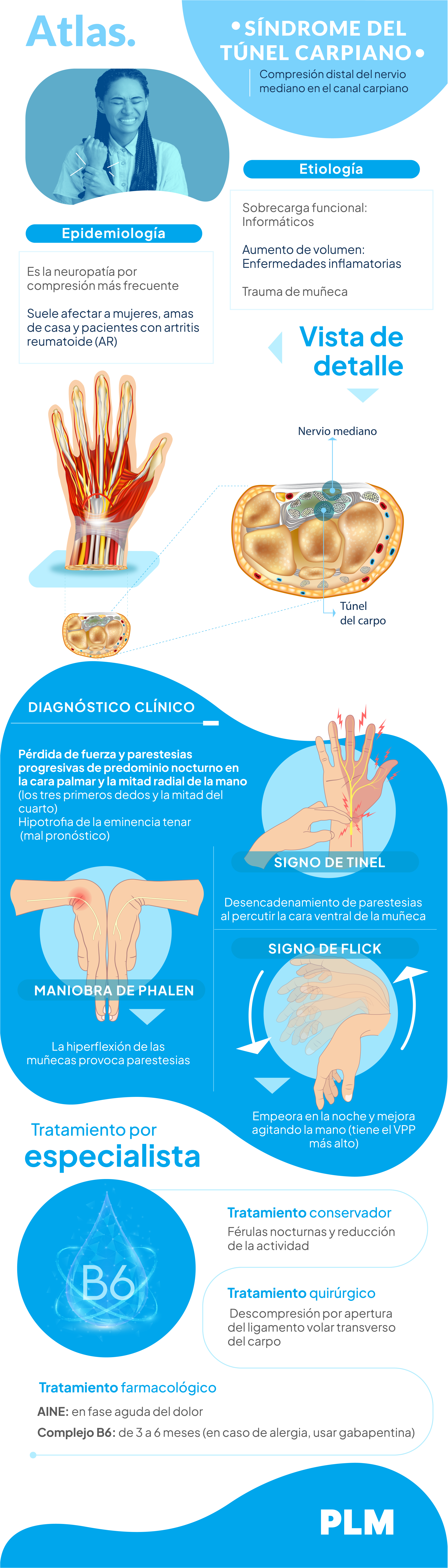 Síndrome del túnel carpiano