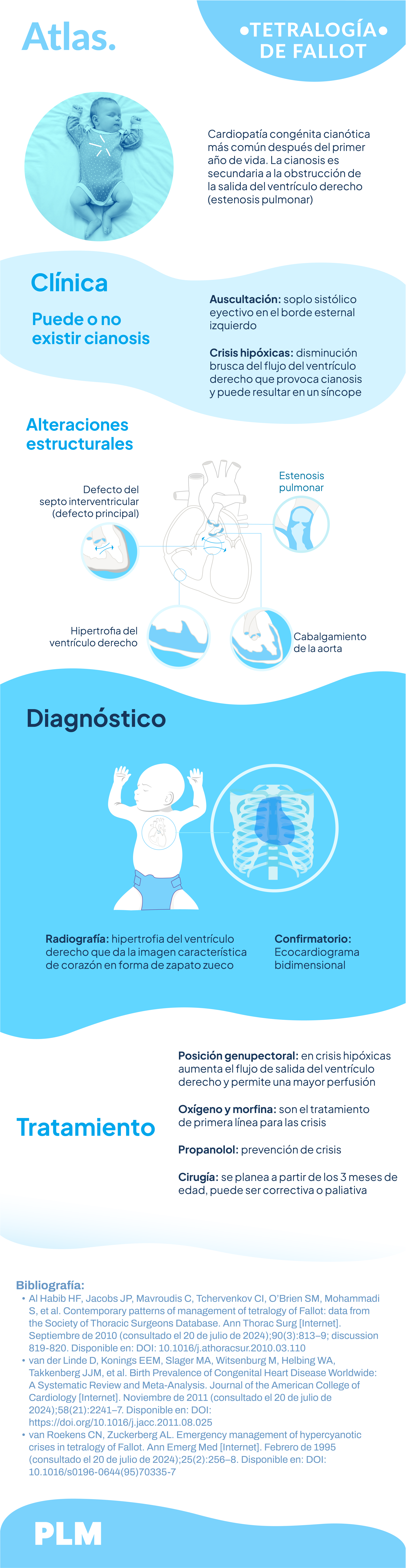 Tetralogía de Fallot