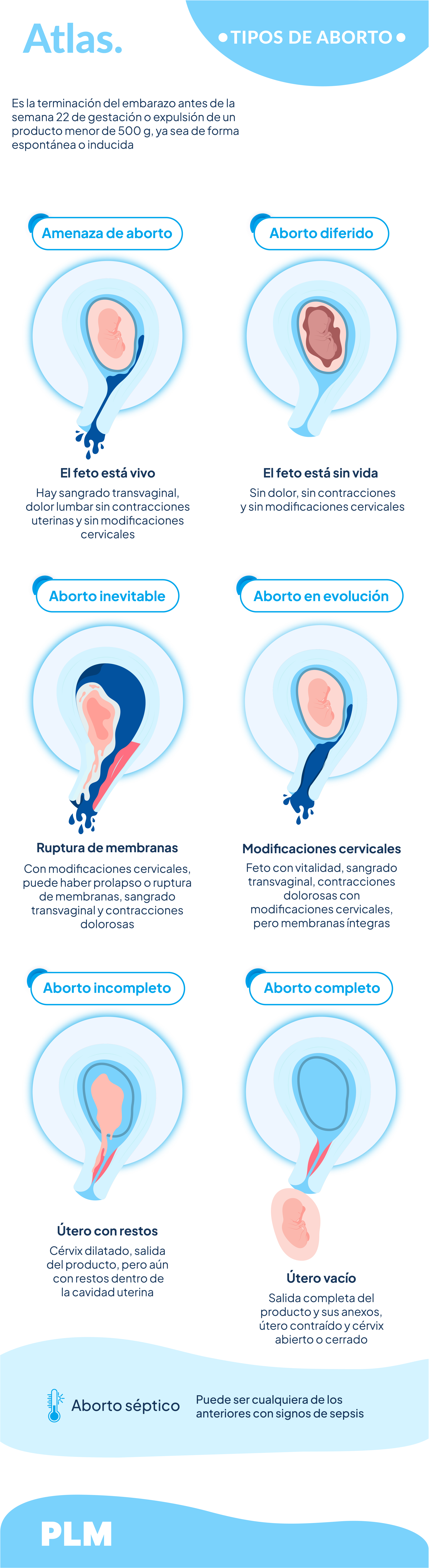 Tipos de aborto