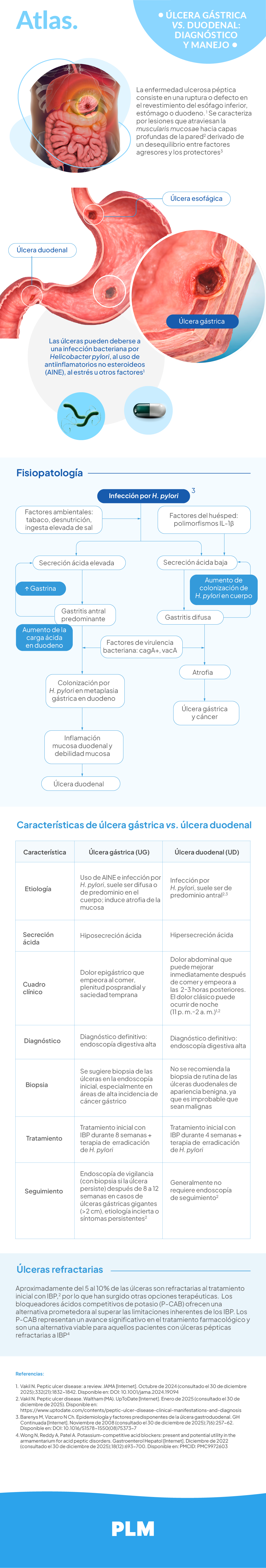 Úlcera gástrica vs. duodenal: diagnóstico y manejo