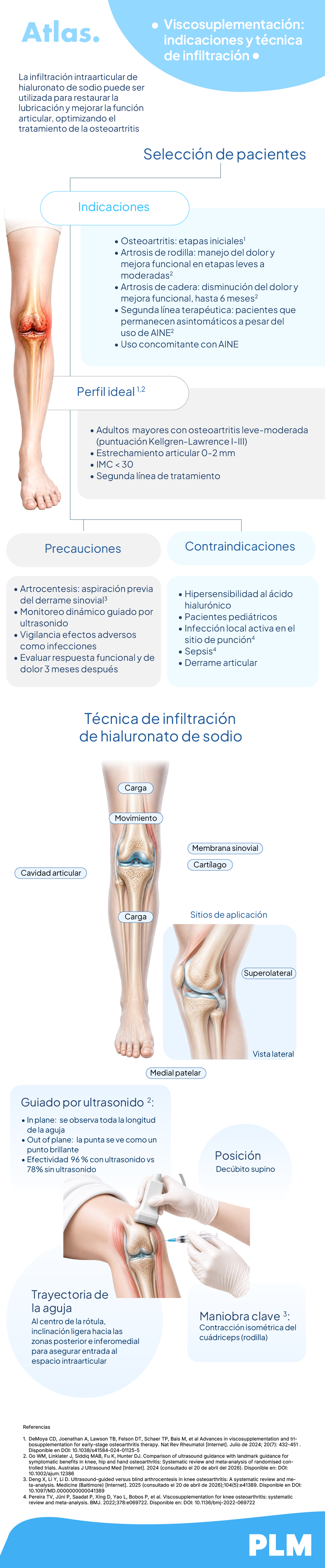 Viscosuplementación: indicaciones y técnica de infiltración