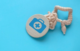 Síndrome de intestino irritable (ROMA)